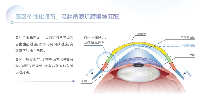 四区个性化调节.png